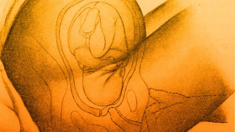 Productos Esenciales para la Salud Sexual y Reproductiva