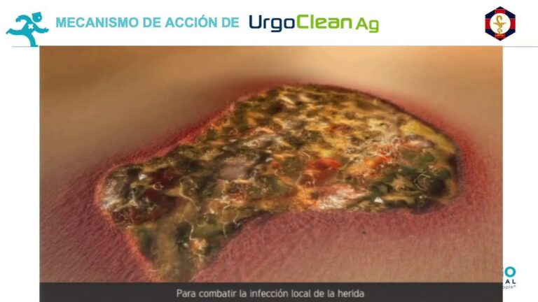 Gu&iacute;a para Elegir Gasas Est&eacute;riles Infantiles en la Farmacia
