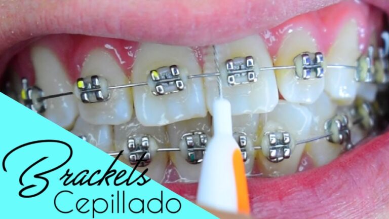 Cepillos de Dientes Eléctricos: Clave para una Higiene Bucal Efectiva