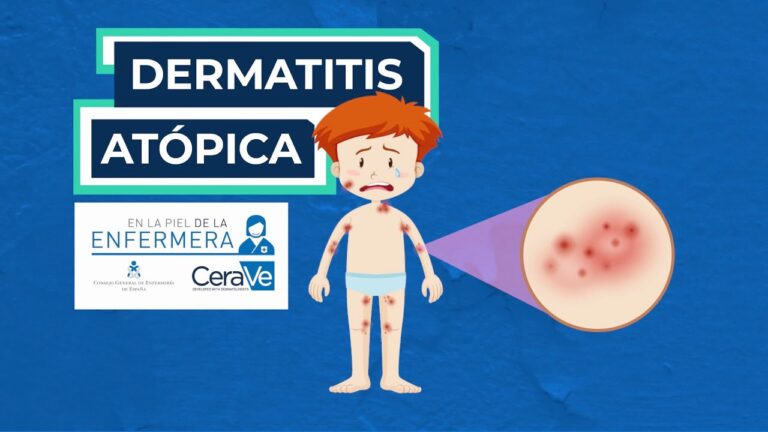 Cuidado Diario del Eczema con Productos de Farmacia