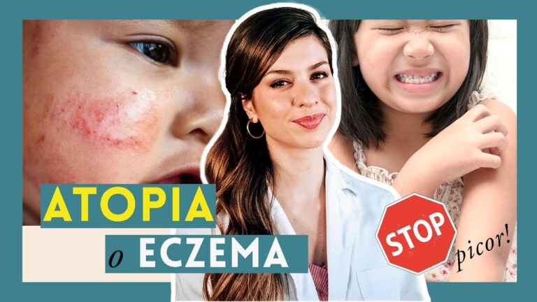 Cremas Pedi&aacute;tricas Efectivas para Problemas de Piel en Ni&ntilde;os