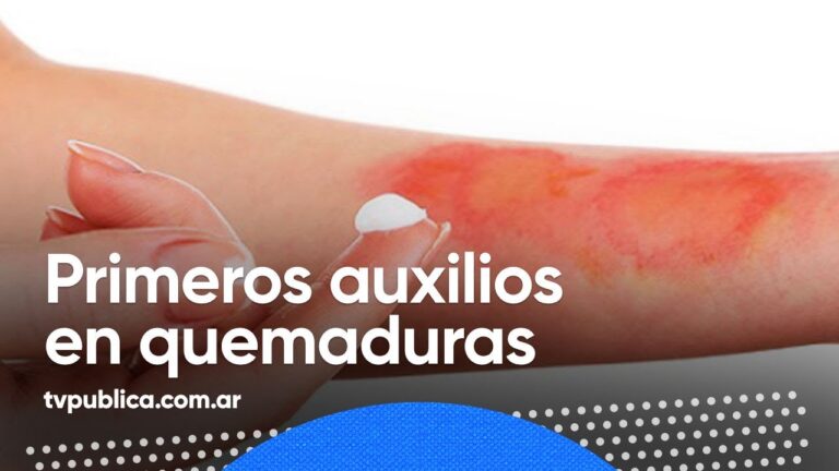 Productos de Farmacia Esenciales para el Cuidado de Quemaduras en Casa