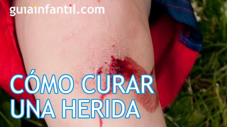 Gu&iacute;a para Elegir la Mejor Crema para Quemaduras Leves en Ni&ntilde;os