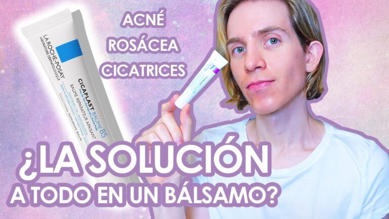 Efectividad de las Cremas Antiestr&iacute;as de Farmacia