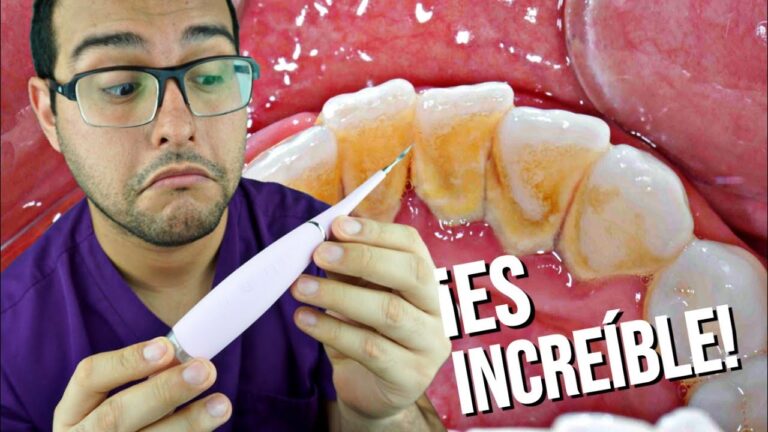 Cintas Dentales de Farmacia para una Limpieza Profunda Efectiva