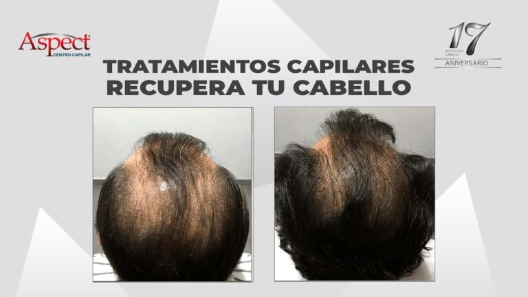 Productos Naturales para Tratamientos No Invasivos: Eficacia y Beneficios