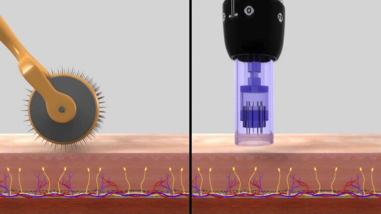 Efectividad de las Ampollas Rejuvenecedoras: &iquest;Realmente Funcionan?