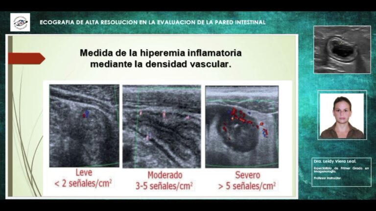 Innovaciones en Tecnolog&iacute;a de Equipos M&eacute;dicos para Sondas Urinarias