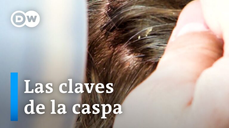 Productos de Cuidado Capilar de Farmacia para Combater la Caspa Suave