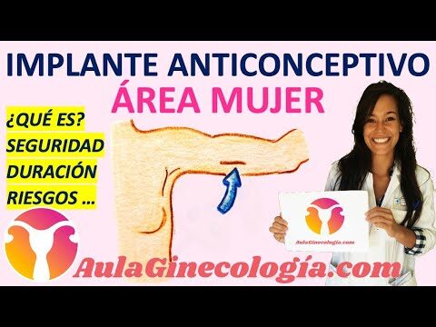 Preservativos Femeninos: Seguridad y Eficacia en la Protección Sexual