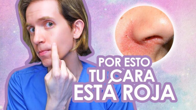 Cuidado Efectivo del Eczema con Productos de Farmacia