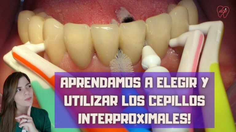 Beneficios de los Cepillos Interdentales para la Salud Dental