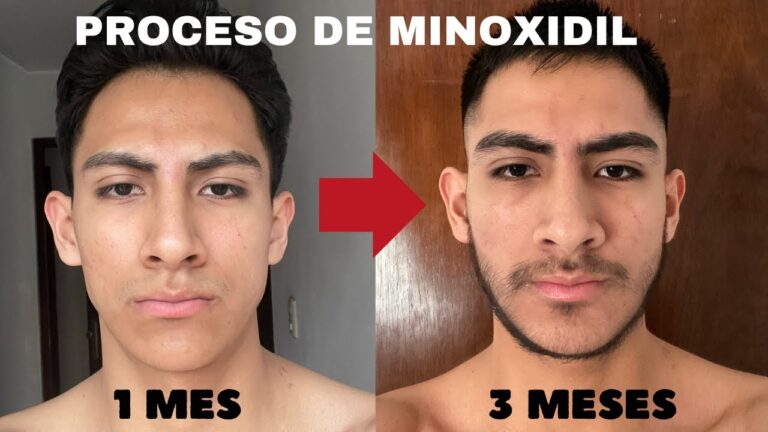 Cuidado Diario de la Barba con Productos de Farmacia