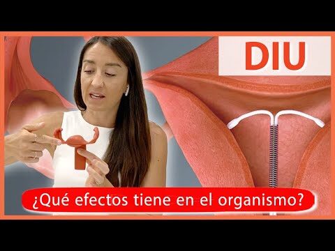 Efectividad del DIU hormonal en la anticoncepci&oacute;n