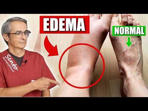 Vitaminas y Suplementos de Farmacia: Claves para tu Bienestar